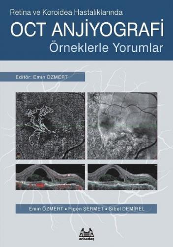 Retina ve Koroidea Hastalıklarında OCT Anjiyografi - Emin Özmert - Ark